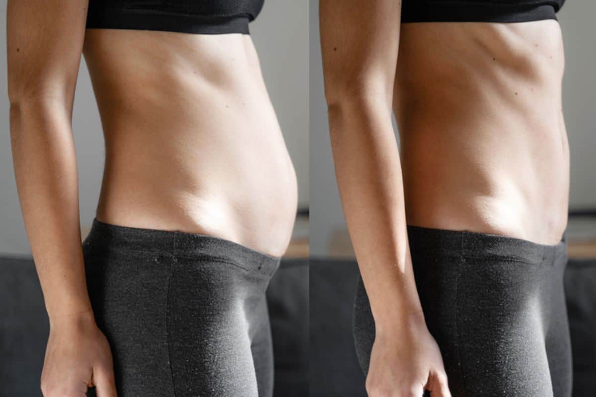 Post-Pregnancy: What Happens to Your Abdominal Muscles After Birth King's Norton