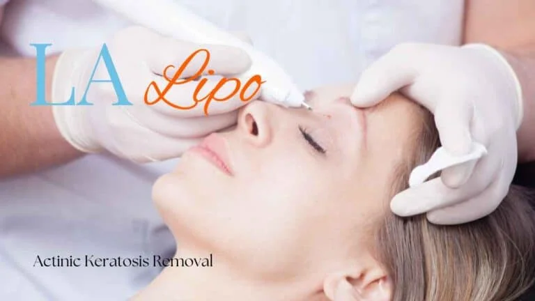 Woman receiving Actinic Keratosis Removal Treatment King's Norton