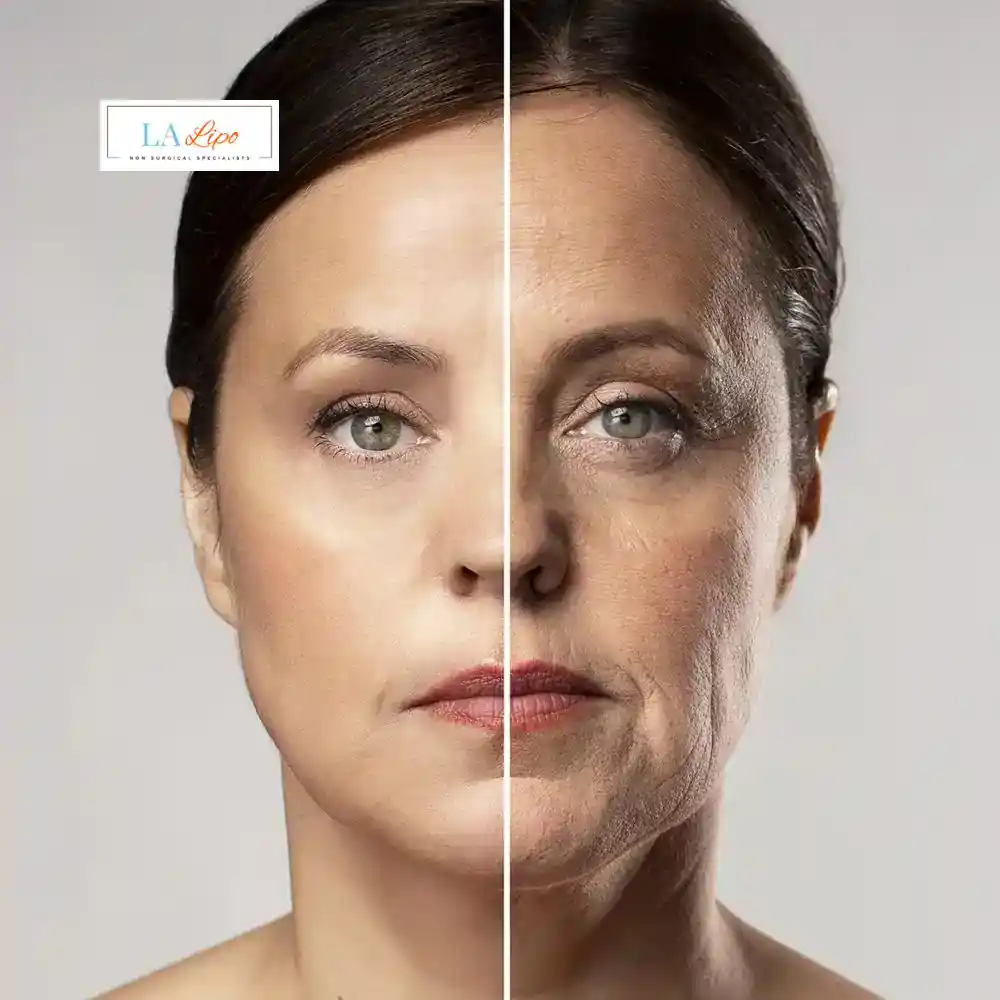 How Can You Tell If Non-Surgical Skin Tightening Is Right for You King's Norton?