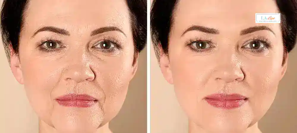 Why Aren’t My Skincare Products Making My Sagging Skin Look Firmer King's Norton?