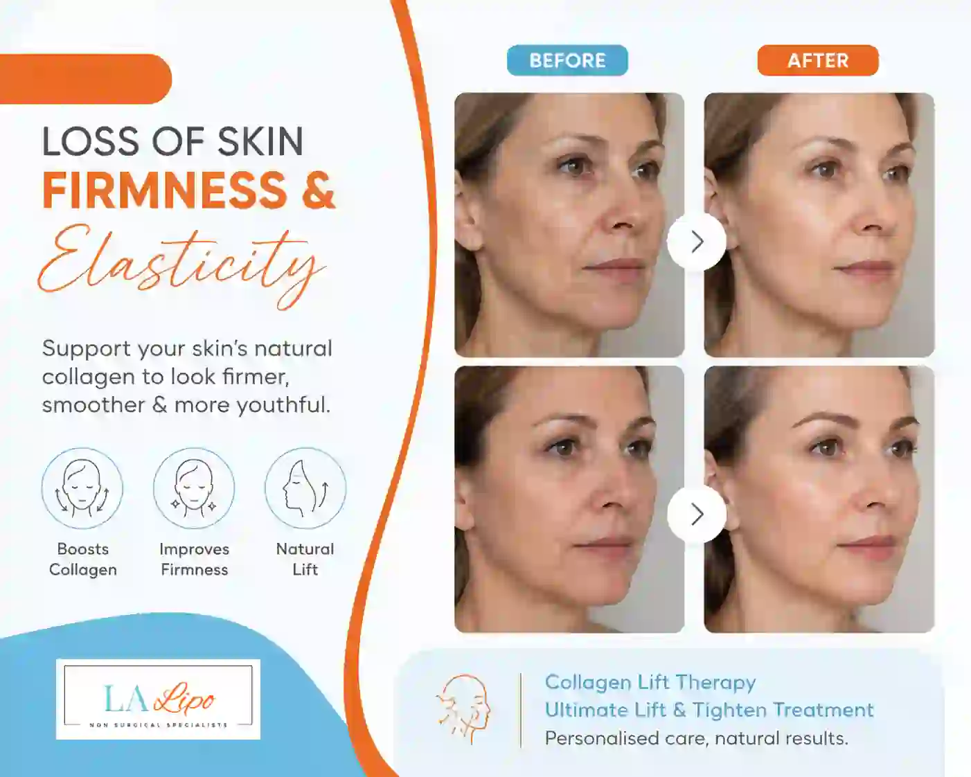 Sign #7: Loss of Skin Firmness and Elasticity King's Norton